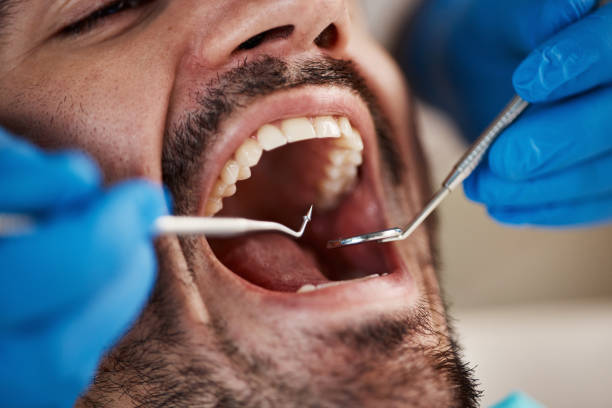 Best Emergency Denture Repair in Allison Rk, PA